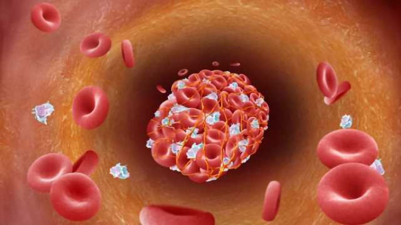 Stroke therapy put to the test in rigorous preclinical study