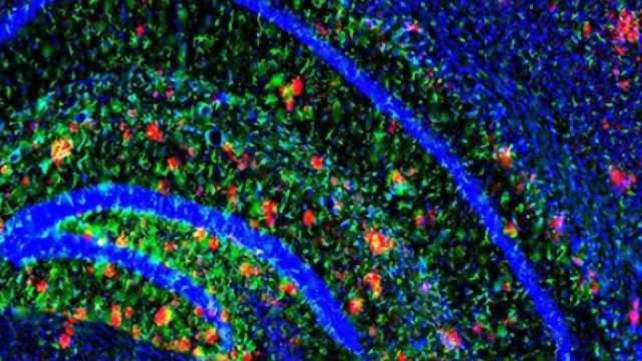 Brain’s ability to dispose of key Alzheimer’s protein drops dramatically with age