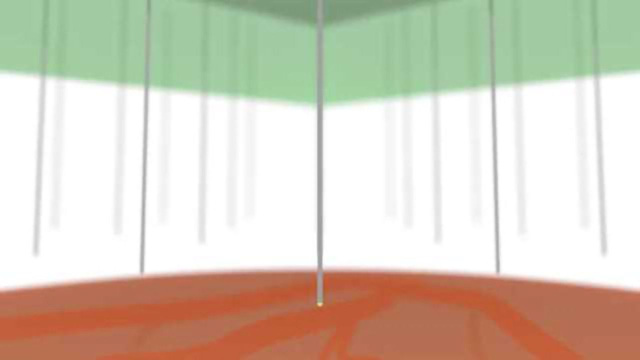 Super-small needle technology for the brain