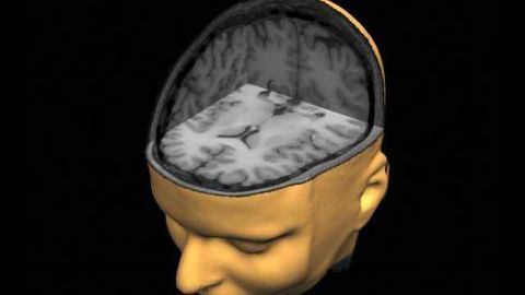 Common medications could delay brain injury recovery