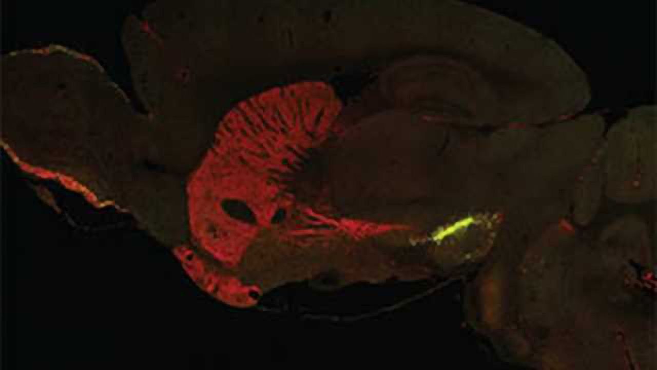 New research sheds light on the molecular origins of Parkinson’s disease