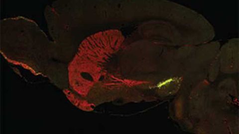 New research sheds light on the molecular origins of Parkinson’s disease