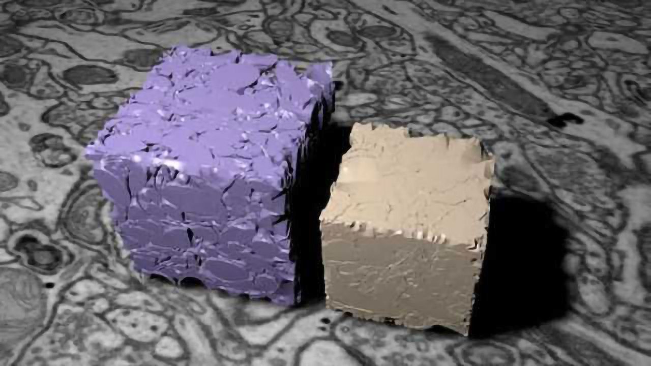 Scientists show the brain is not as cramped and compact as we thought