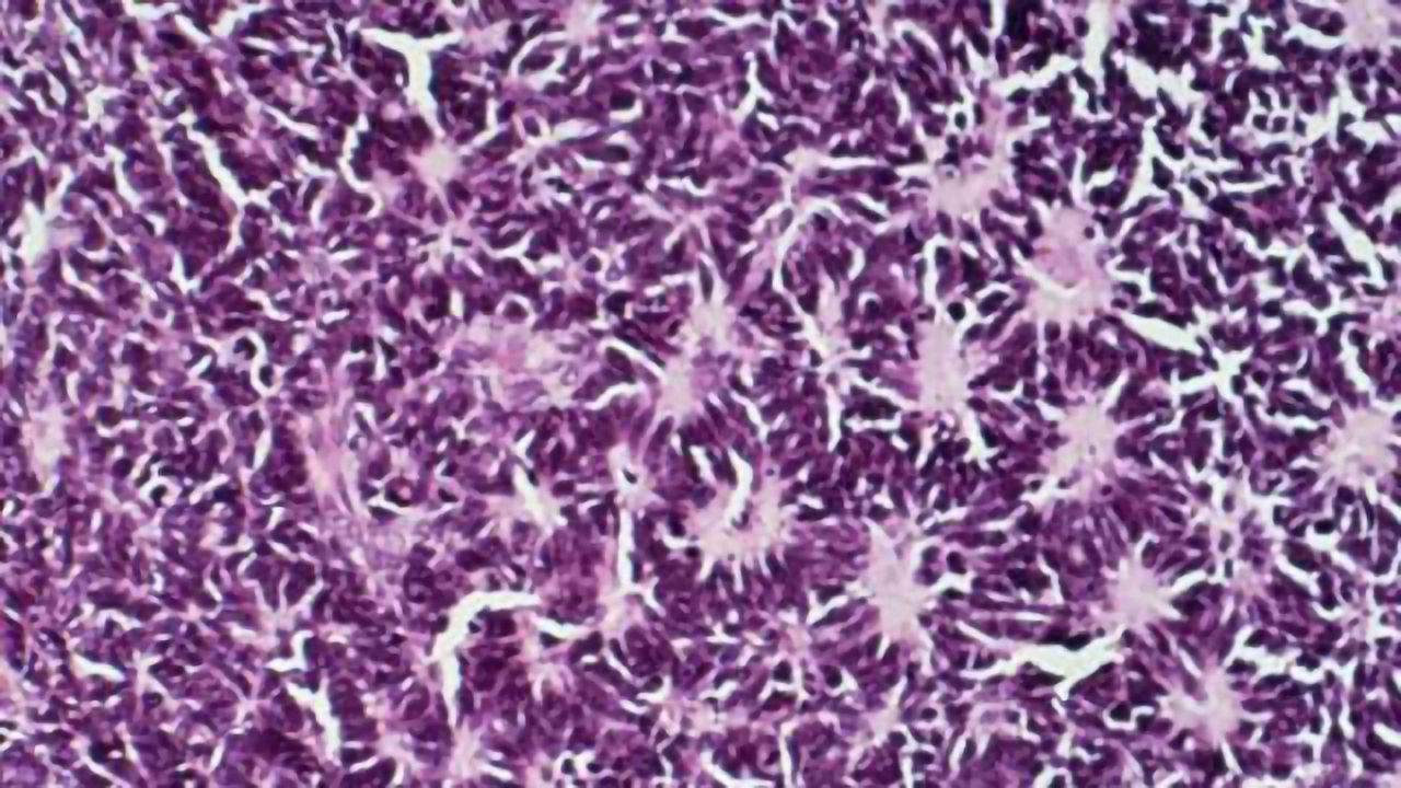 Common class of 'channel blocking' drugs may find a role in cancer therapy