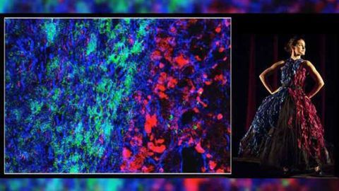 Target healthy cells to stop brain cancer “hijack”: study