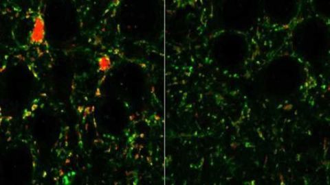Receptors in brain linked to schizophrenia, autism