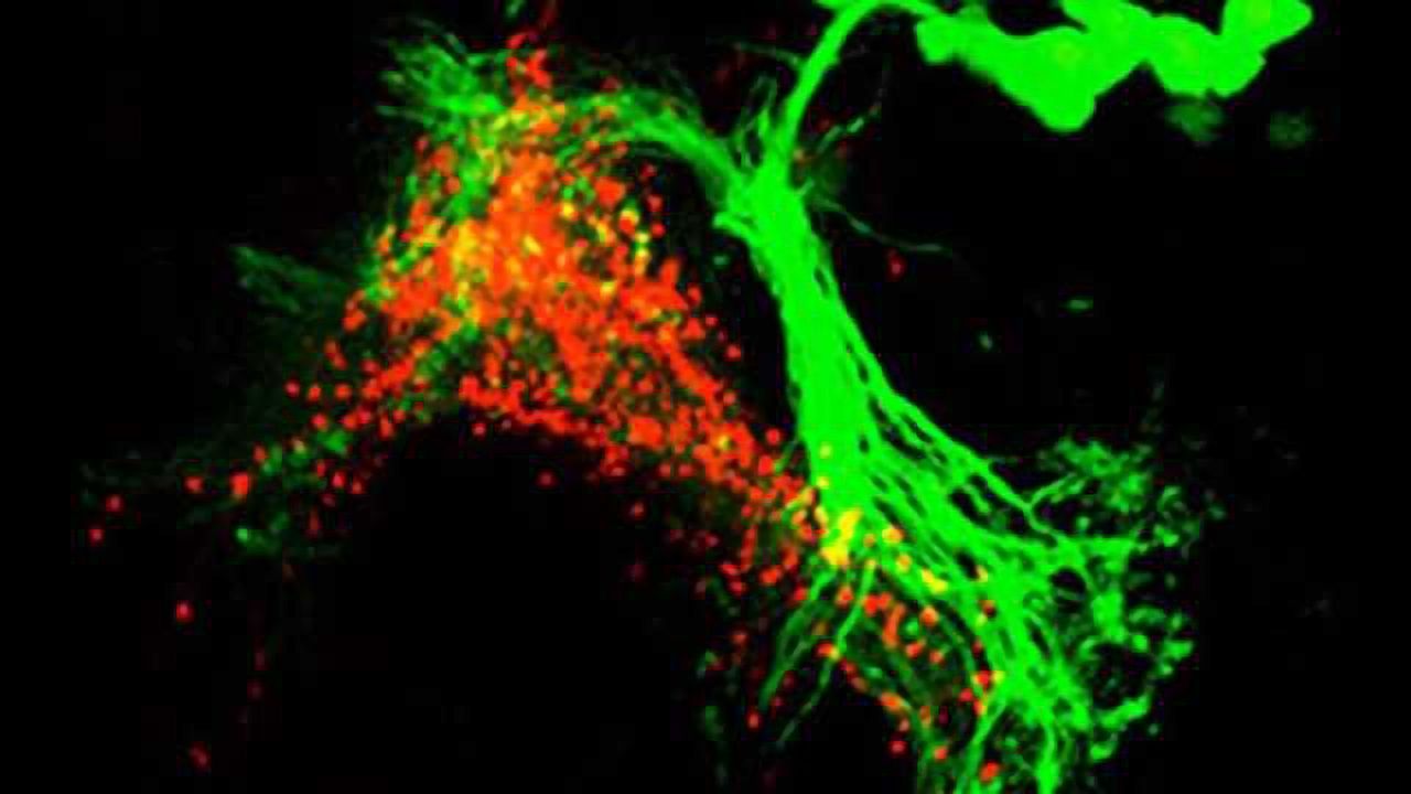 In exploring a fly’s choice of a mate, researchers track the neural circuits that bridge sensory perception and behavioral action