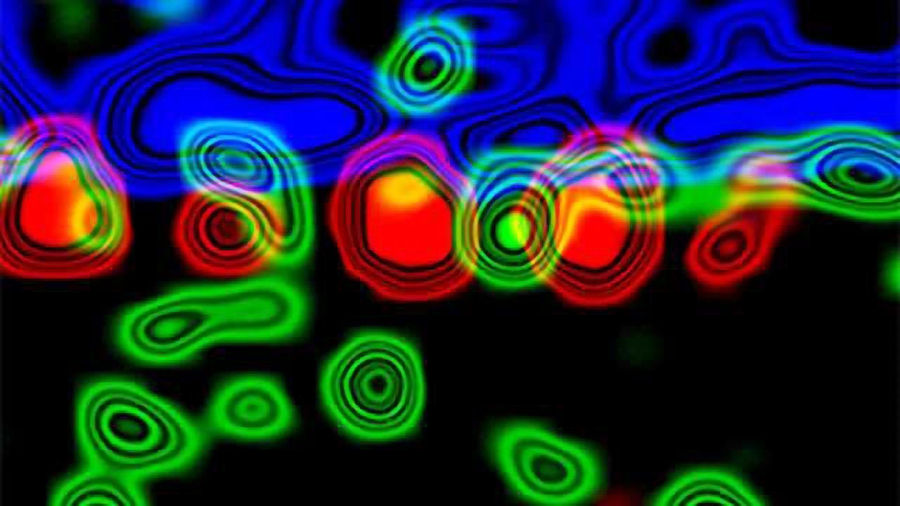 Scientists uncover nuclear process in the brain that may affect disease