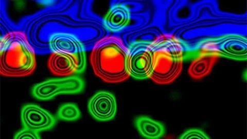 Scientists uncover nuclear process in the brain that may affect disease