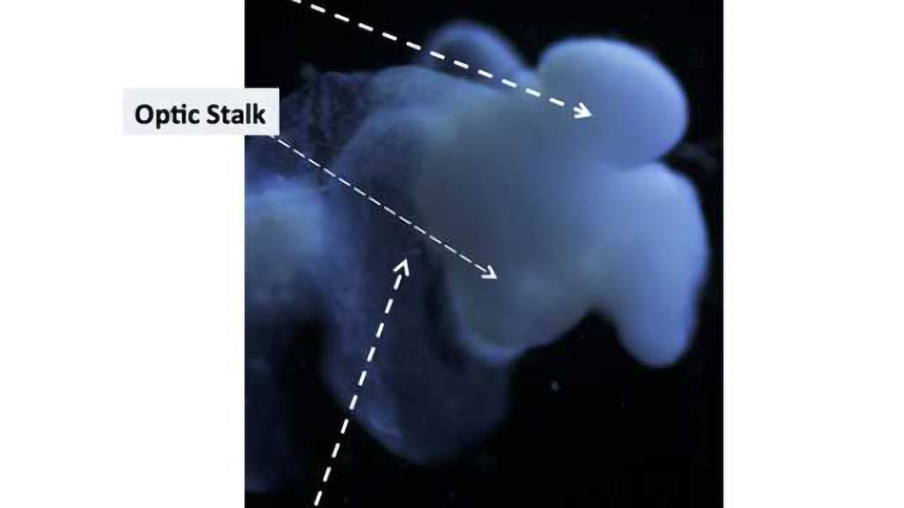 Scientist: Most complete human brain model to date is a ‘brain changer’