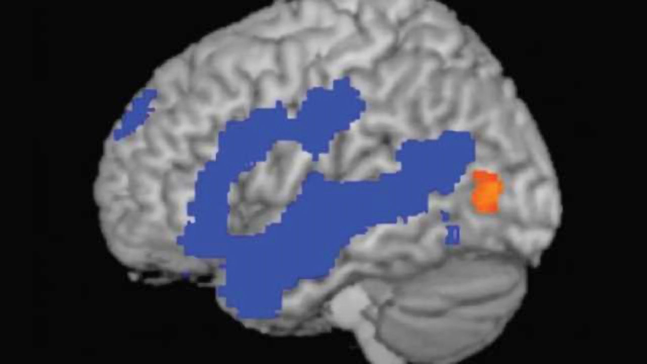 The amazing adaptability of the brain's vision center