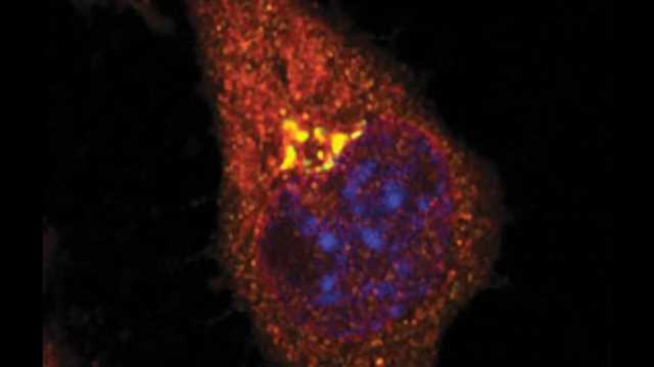 A newly discovered molecular feedback process may protect the brain against Alzheimer’s