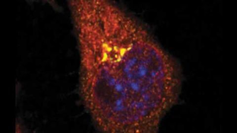 A newly discovered molecular feedback process may protect the brain against Alzheimer’s
