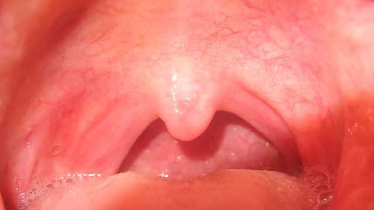 Saliva test for stress hormone levels may identify healthy older people with thinking problems
