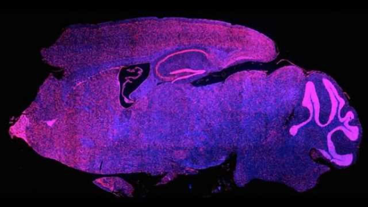 Promising class of new cancer drugs causes memory loss in mice