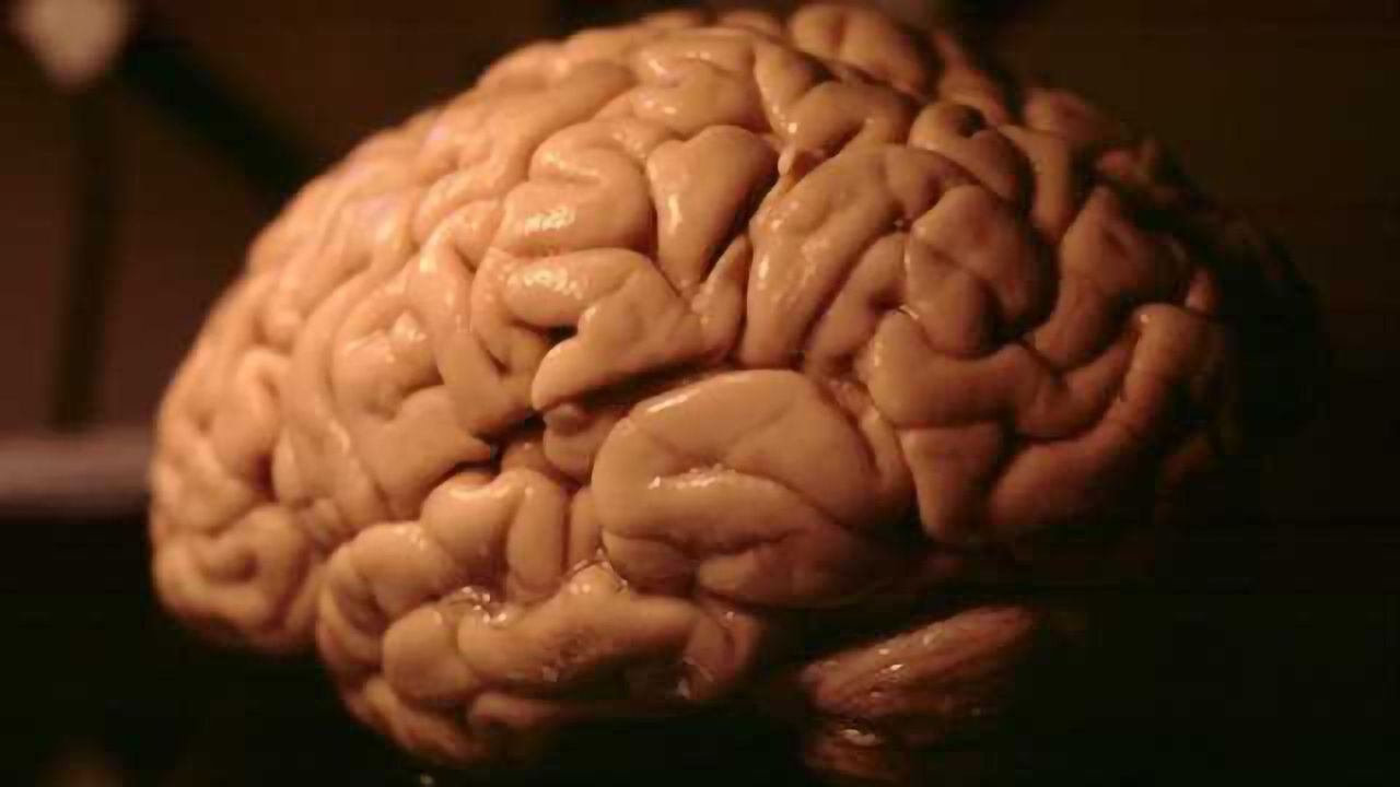 Alzheimer's disease is thought to be accelerated by an abnormal build-up of fat in the brain