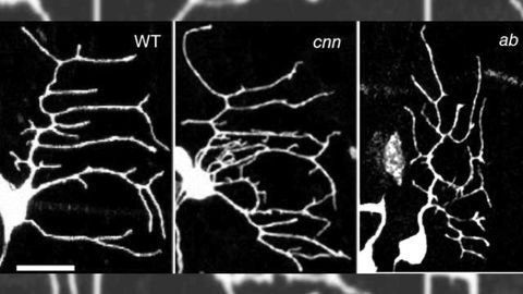 How neurons get their branching shapes