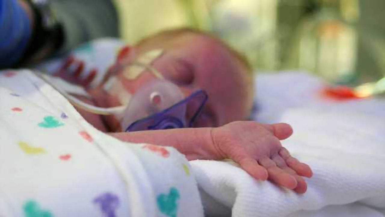 The risk of cognitive impairment in children born prematurely may be predicted using MRI after birth