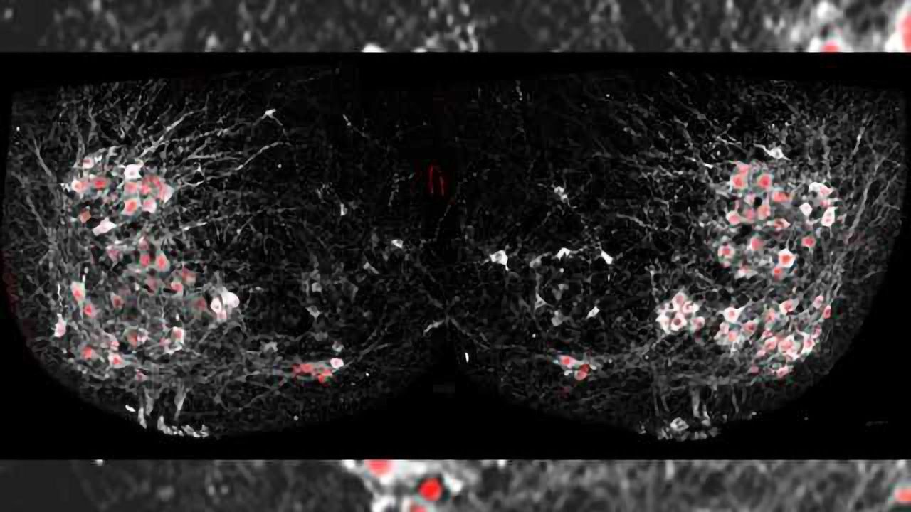 Scientists see motor neurons 'walking' in real time