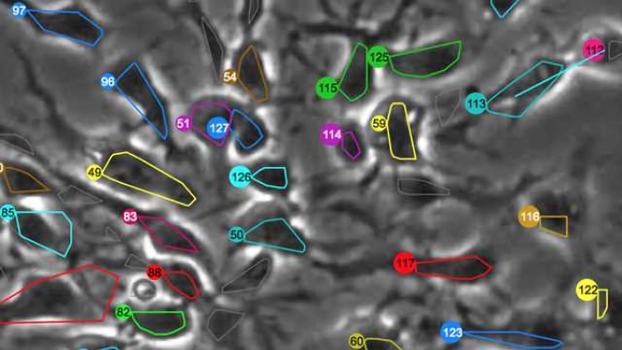 Image-tracking technology allows scientists to observe nature vs. nurture in neural stem cells