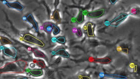 Image-tracking technology allows scientists to observe nature vs. nurture in neural stem cells