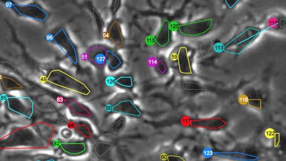 Image-tracking technology allows scientists to observe nature vs. nurture in neural stem cells content piece image