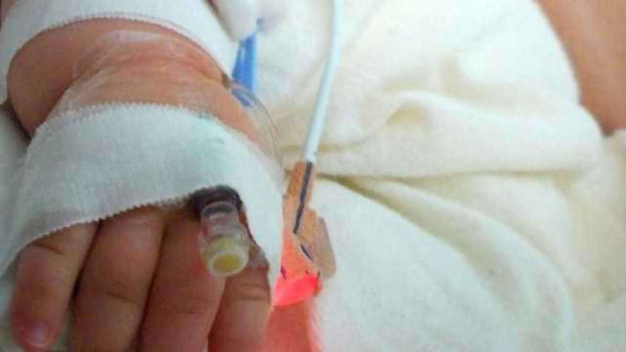 Study finds emotional behavior altered after multiple exposures to anesthesia during infancy