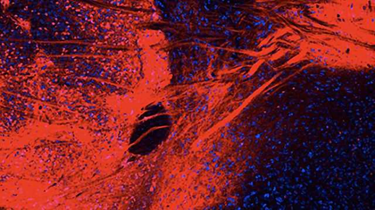 Reward, aversion behaviors activated through same brain pathways??