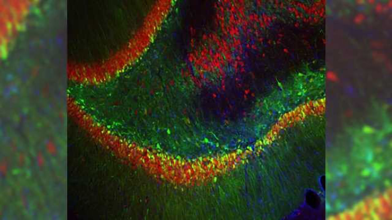 A new factor in depression? Brain protein discovery could lead to better treatments