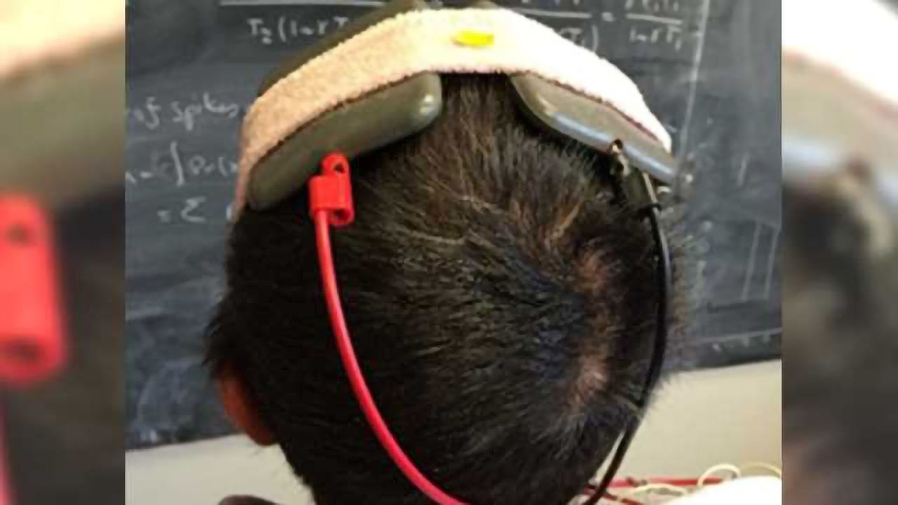 Pilot study: Noninvasive brain stimulation temporarily improves motor symptoms in people with Parkinson’s disease