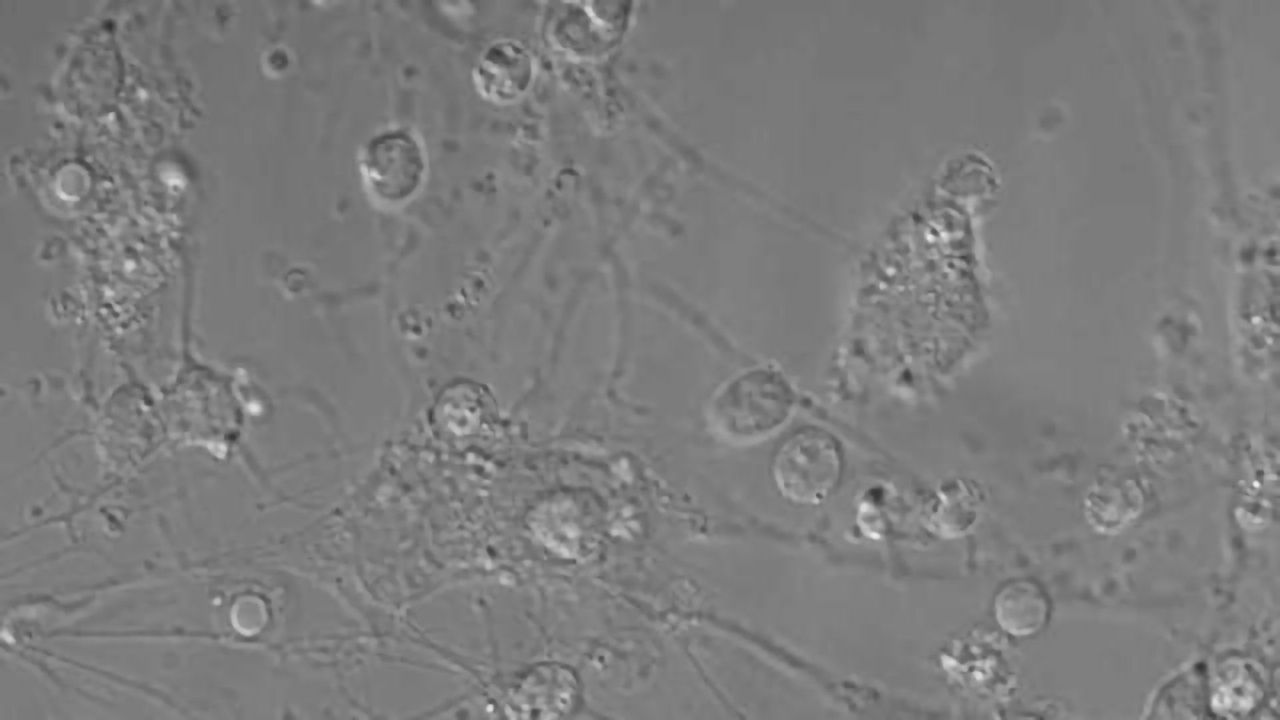 'Smart' immune cells teach neurons damaged by Parkinson’s to heal themselves