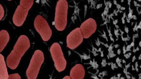 Keeping gut bacteria in balance could help delay age-related diseases, study finds