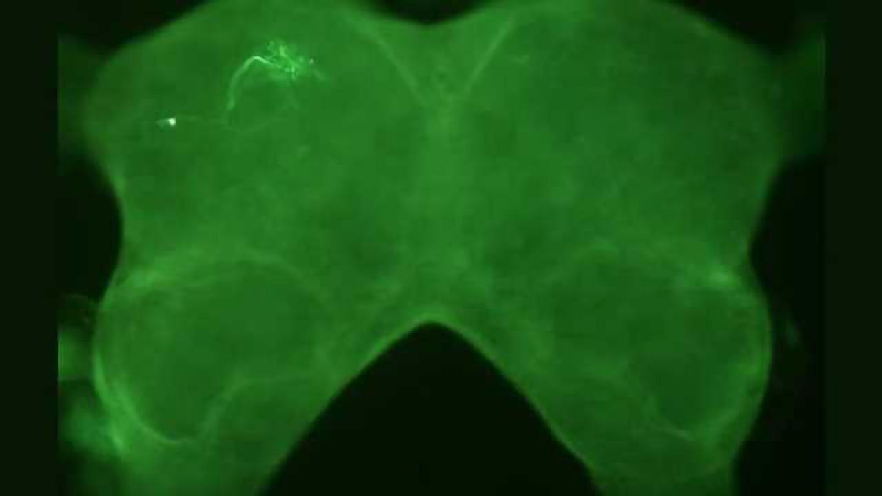 Neural circuit in the cricket brain detects the rhythm of the right mating call