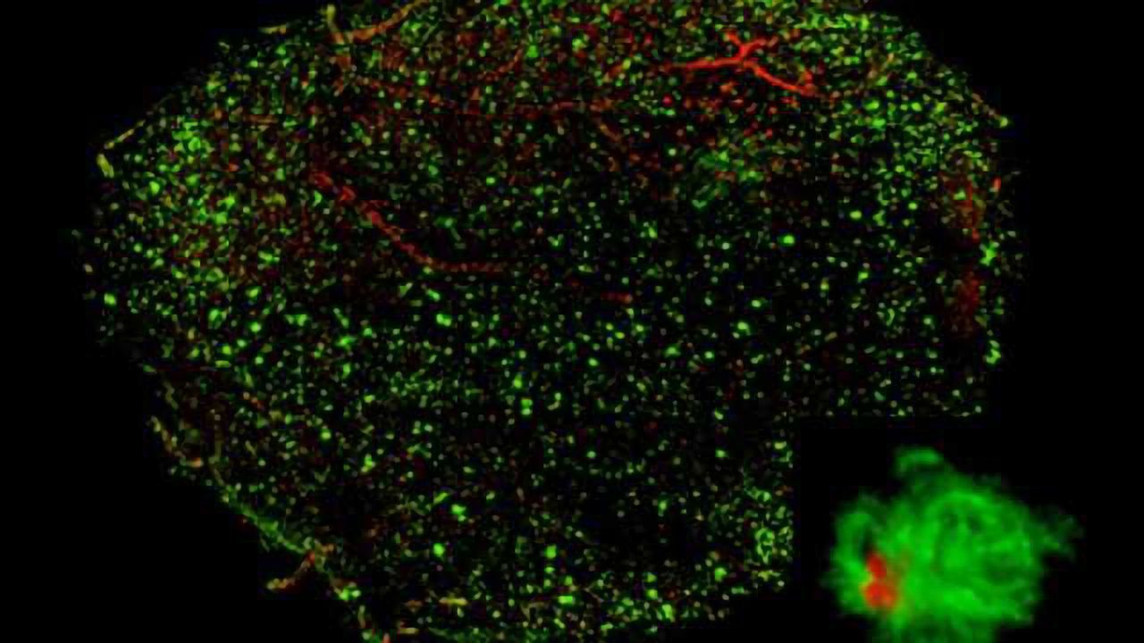 Real x-ray vision: See-through brains ready for study