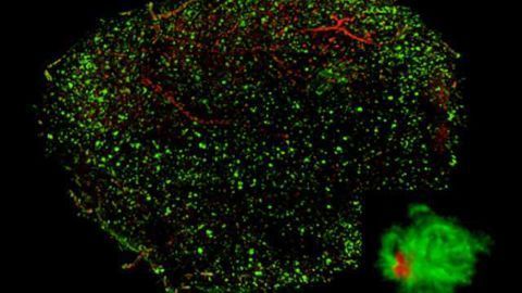 Real x-ray vision: See-through brains ready for study
