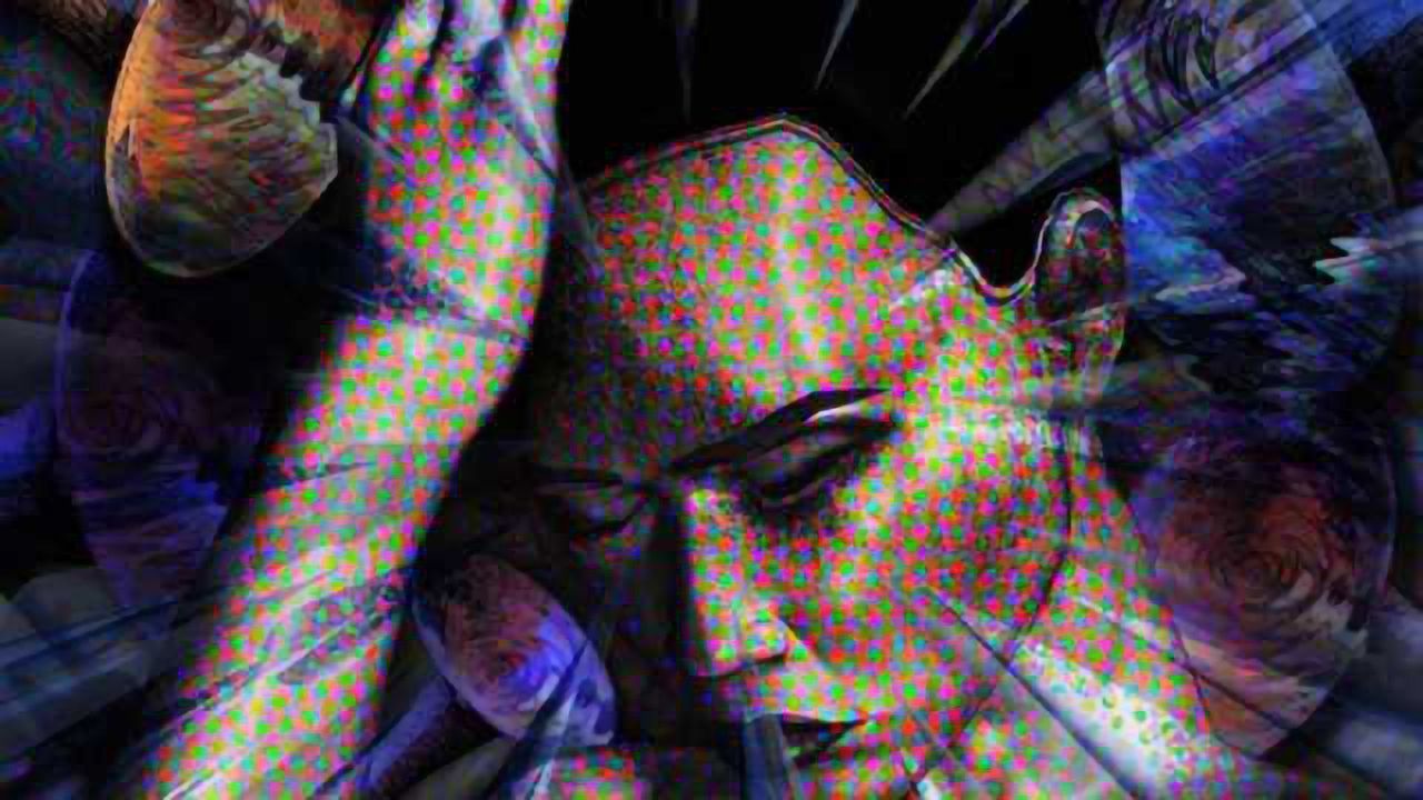 A new marker for migraine?