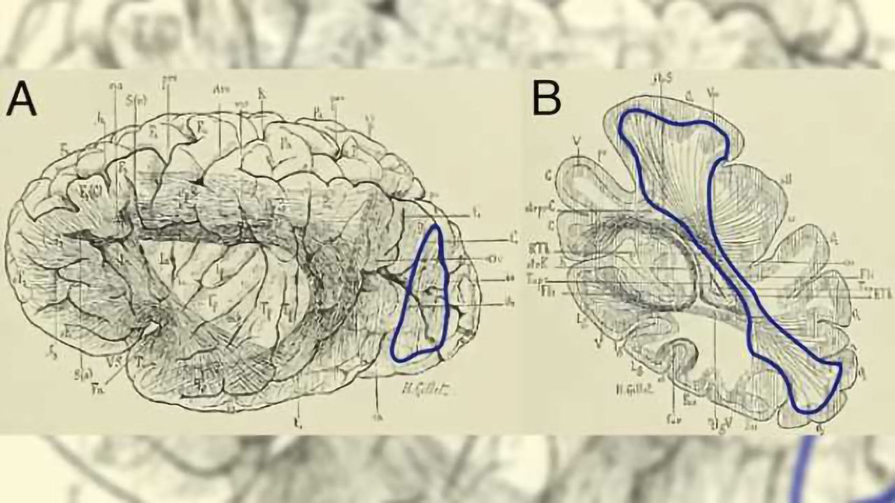 Scientists chart a lost highway in the brain