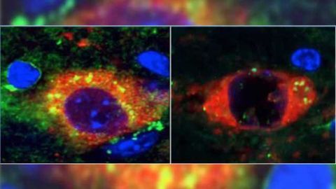 Rapamycin prevents Parkinson's in mouse model of incurable neurodegenerative disease