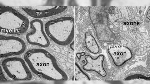 New technique to better see -- and study -- the interface where two cells touch