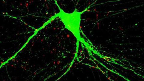 Repairing the brain - Two genes unlock potential for treatment of schizophrenia