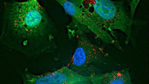 New way found to combat brain cancer spread