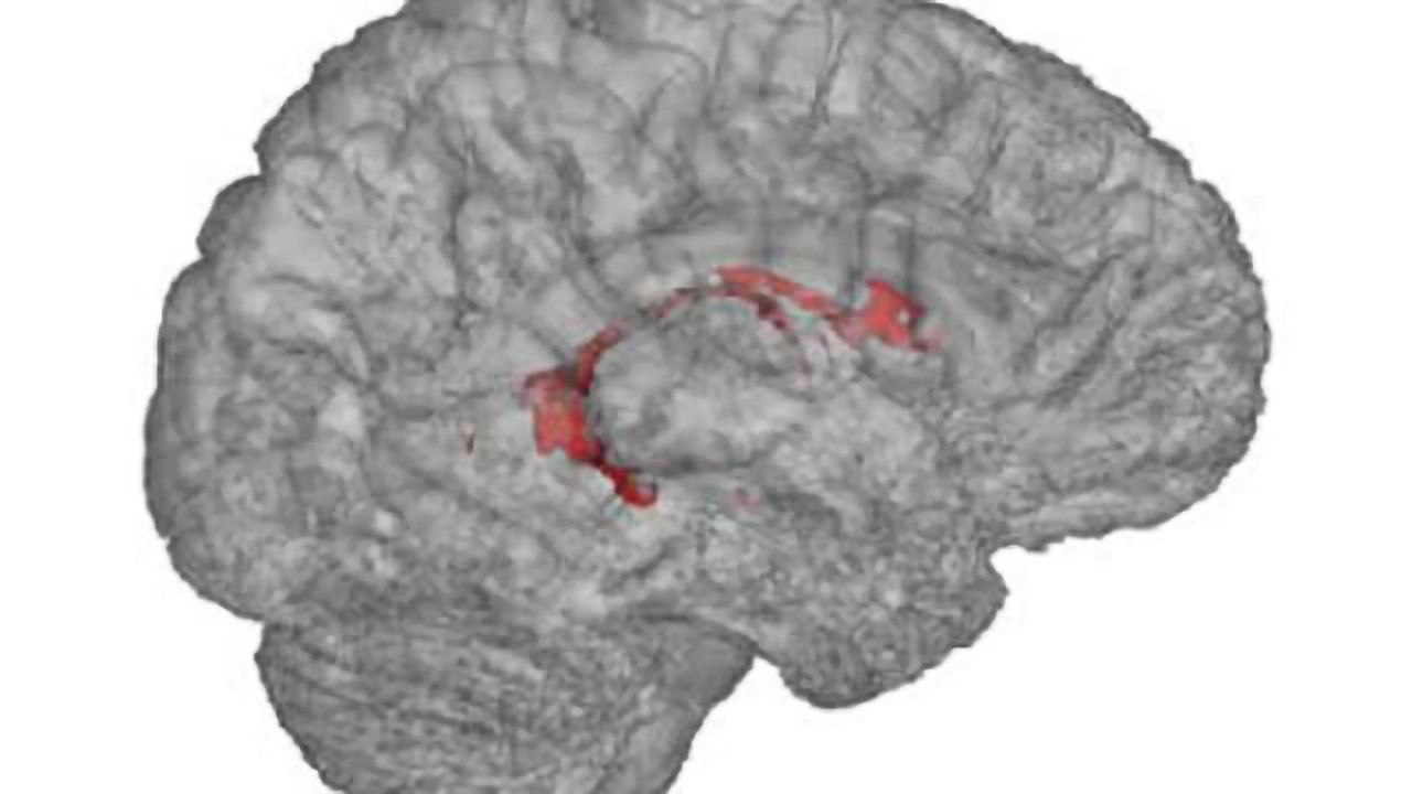 Unexpected link between choroid plexus, chronic pain
