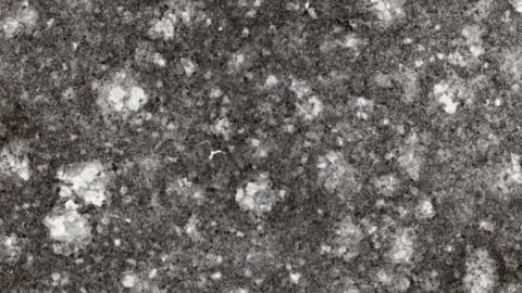 Prion disease detected soon after infection and in surprising place in mouse brains