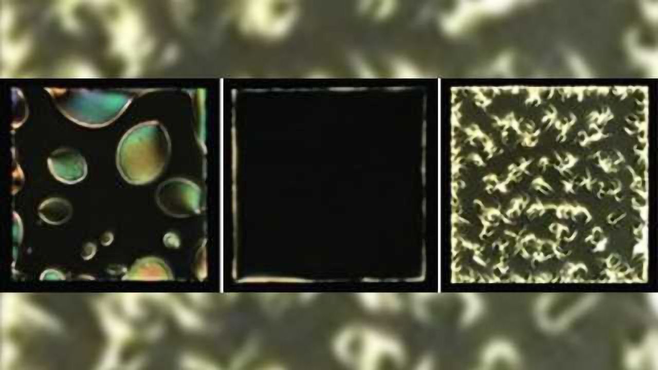 Liquid crystals show potential for detection of neuro-degenerative disease