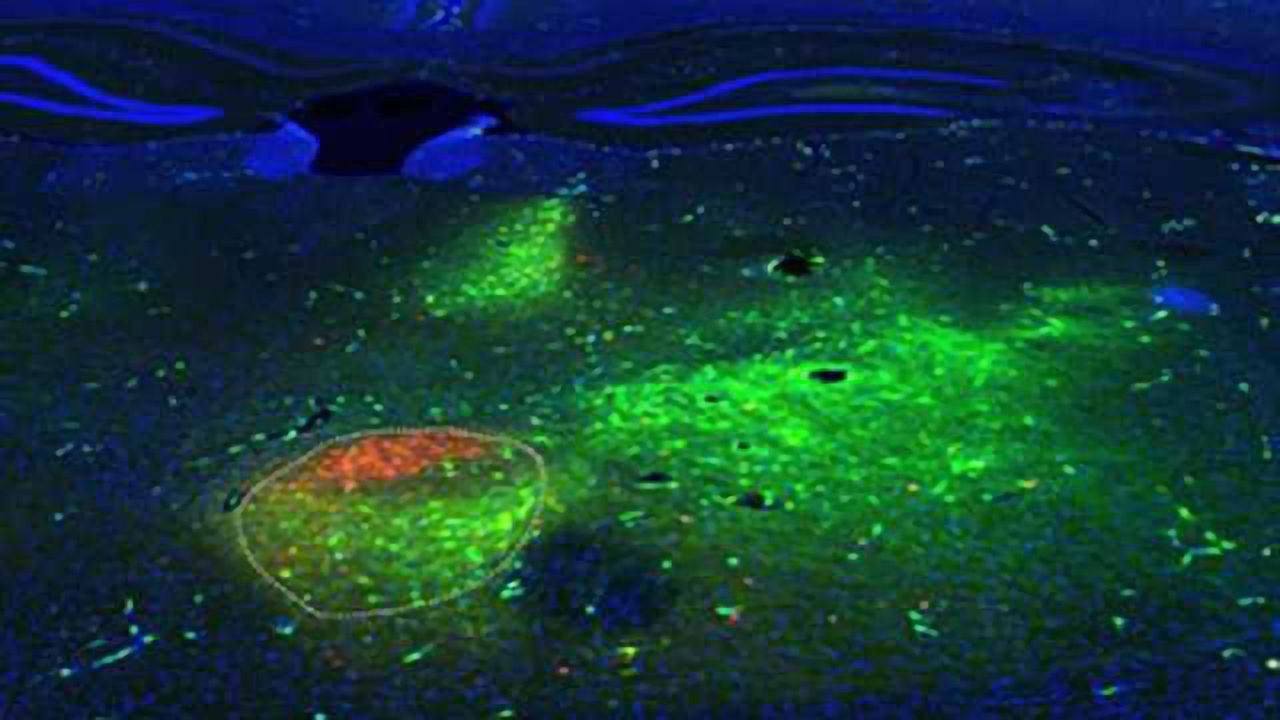 Decision-making involves a little known brain region
