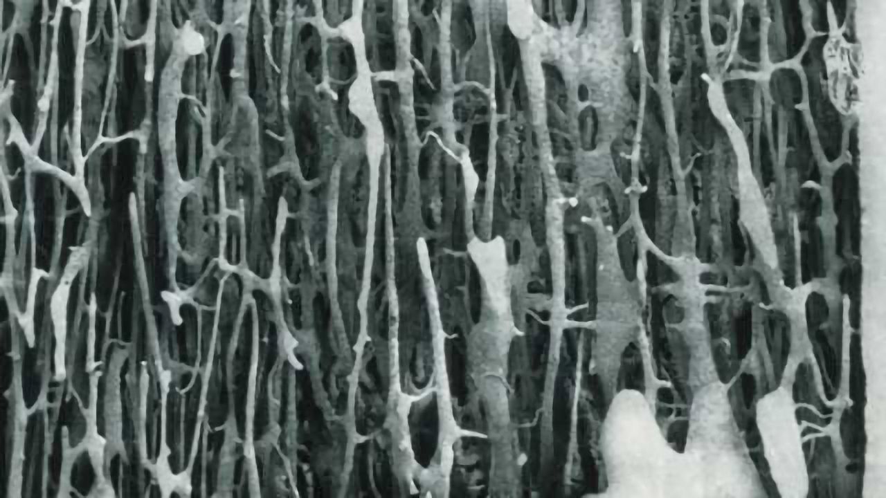 Of brains and bones: How hunger neurons control bone mass