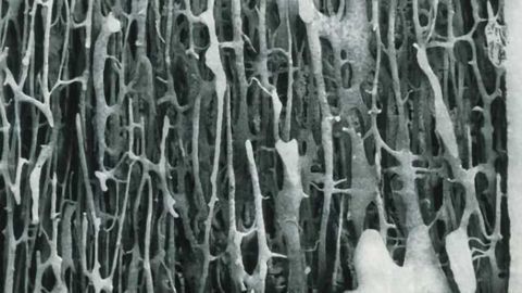 Of brains and bones: How hunger neurons control bone mass