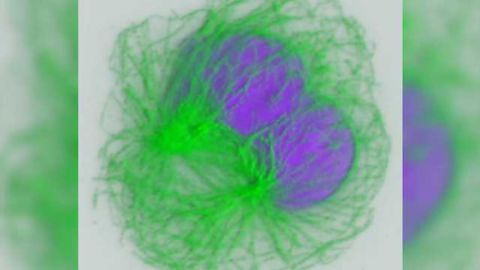Connecting Alzheimer's disease and the immune system