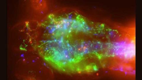 Meningitis model shows infection’s sci-fi-worthy creep into the brain