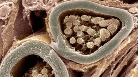 Experimental cancer drug shows therapeutic promise in mouse models of multiple sclerosis